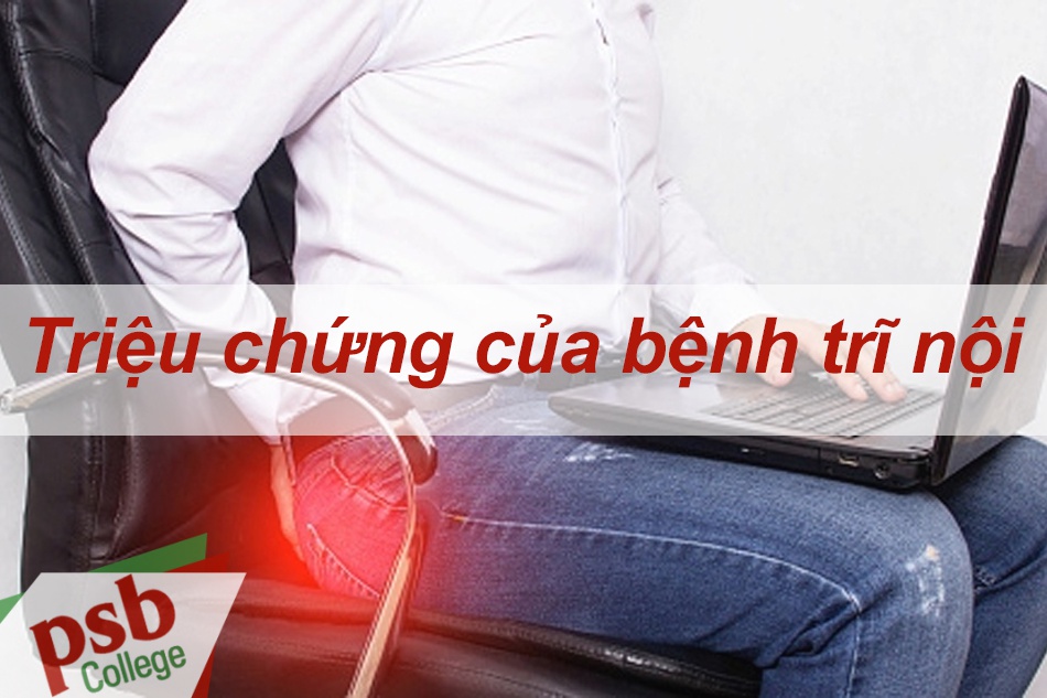 Triệu chứng của bệnh trĩ nội