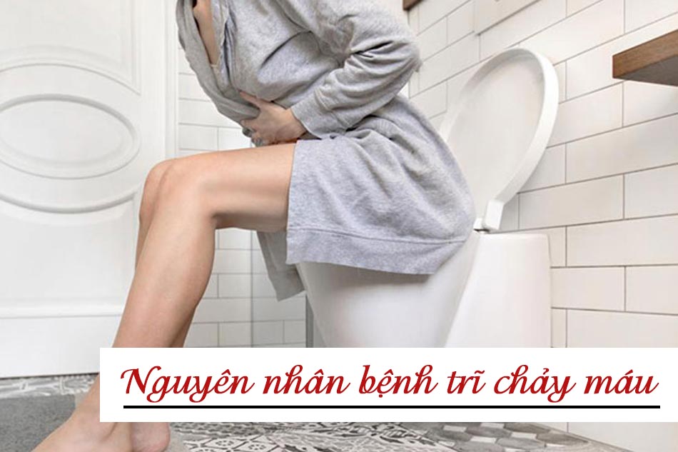 Nguyên nhân bệnh trĩ chảy máu
