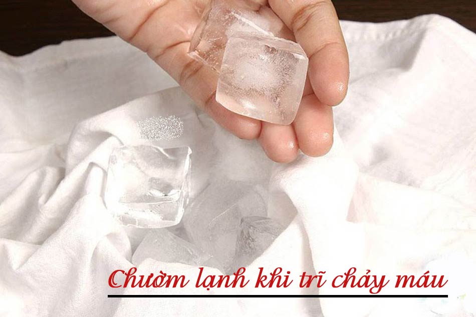 Chườm lạnh khi bị chảy máu trĩ