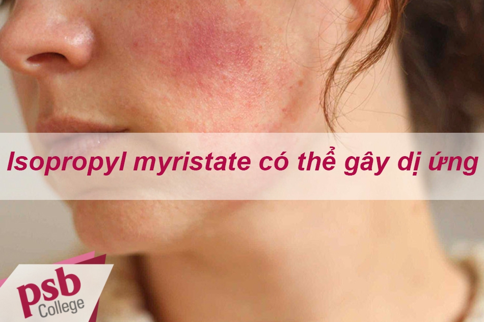Isopropyl myristate có thể gây kích ứng
