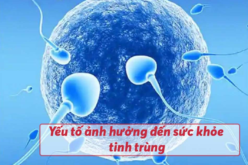 Yếu tố ảnh hưởng đến sức khỏe tinh trùng