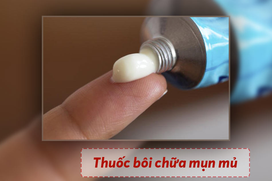 Thuốc bôi chữa mụn mủ trên đầu