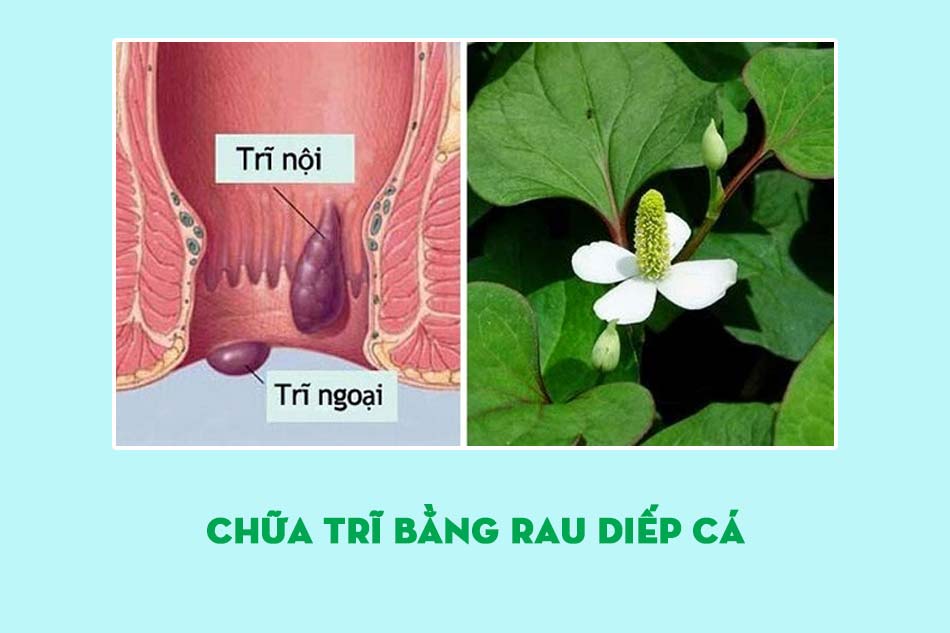 Dùng rau diếp cá chữa triệu chứng bệnh trĩ