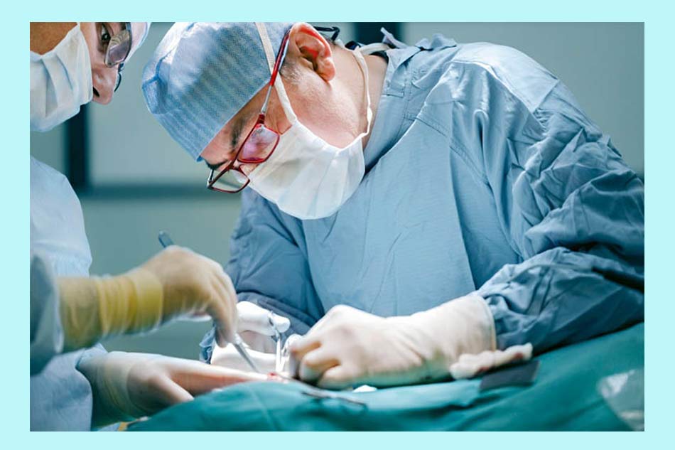 Cần cắt trĩ khi bệnh trĩ ở giai đoạn nào?