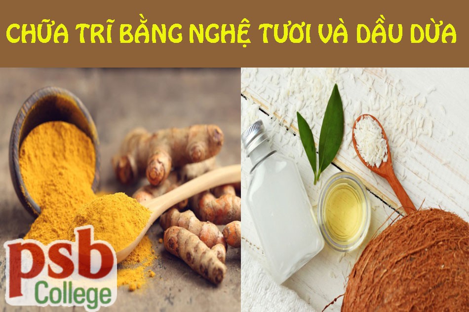 Kết hợp nghệ tươi và dầu dừa chữa trĩ