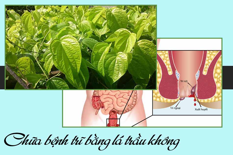 Chữa bệnh trĩ bằng lá trầu không