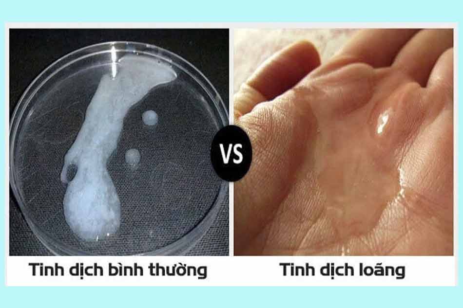 Dấu hiệu nhận biết loãng tinh