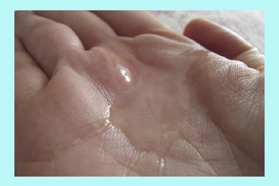 Loãng tinh là gì?