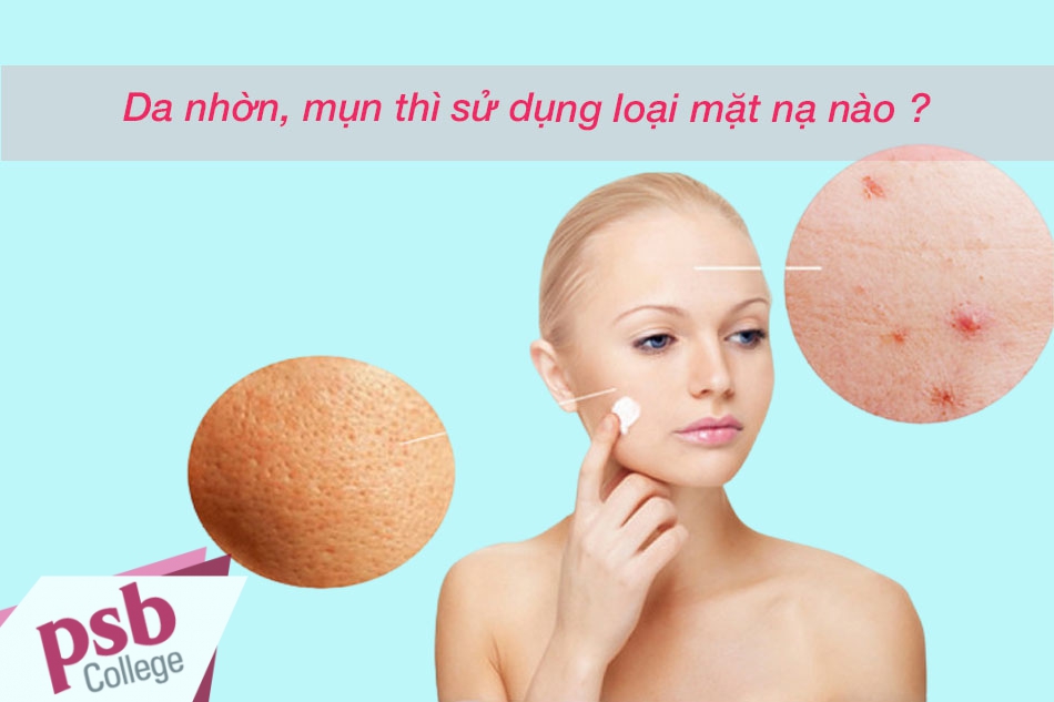 Da nhờn, da mụn luôn là nỗi lo của nữ giới.