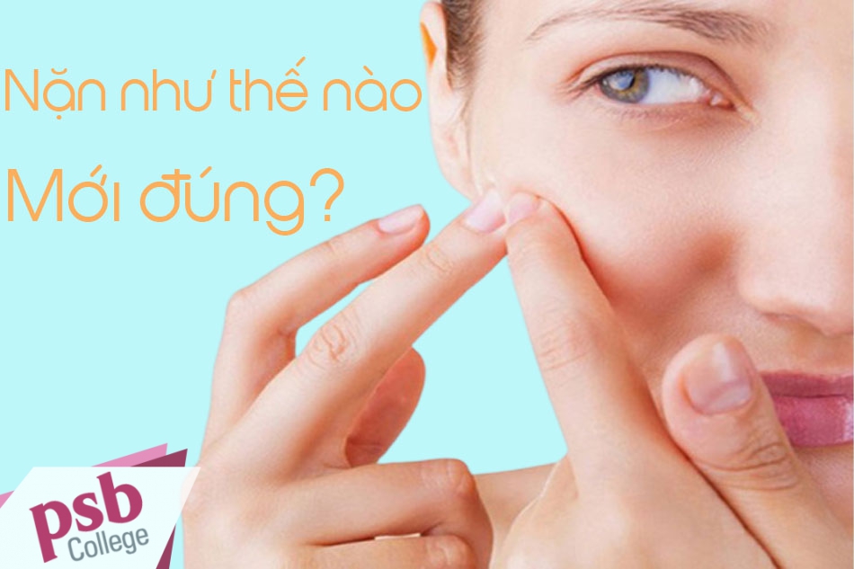 Nặn mụn đúng cách 