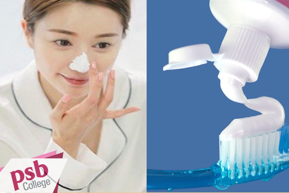 Trị mụn bằng kem đánh răng