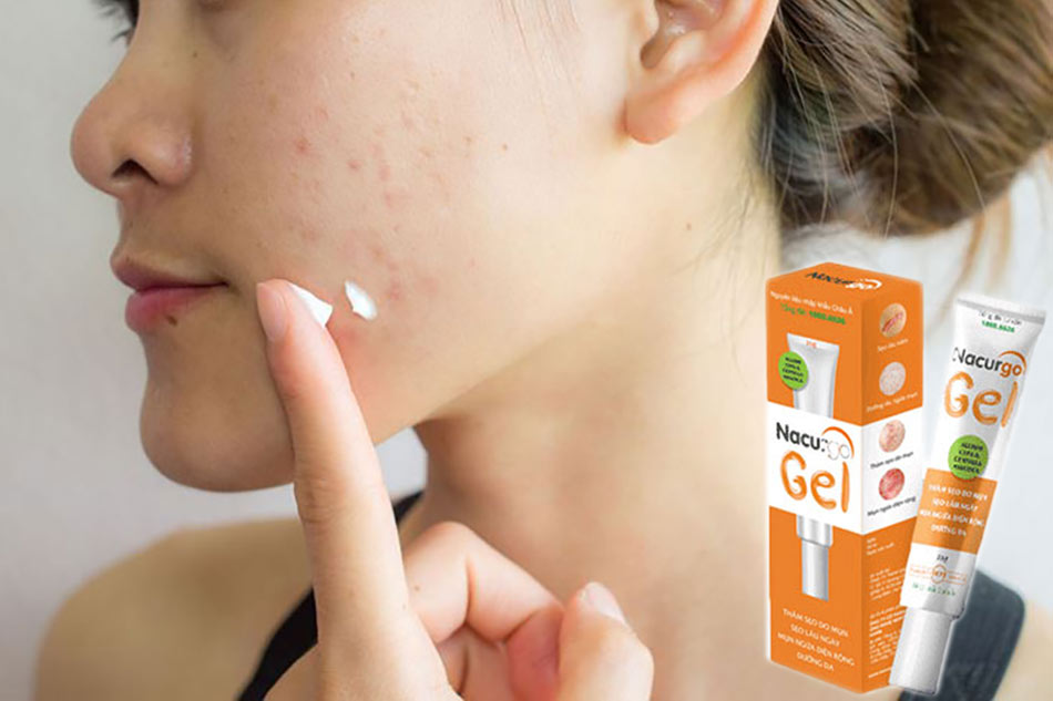 Hình ảnh Nacurgo Gel