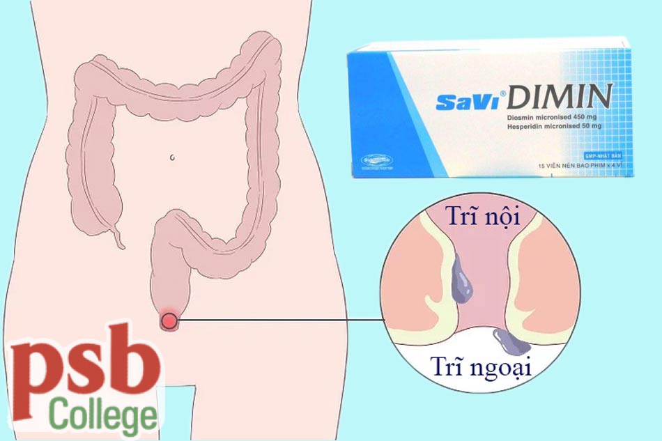 Hình ảnh Savi Dimin