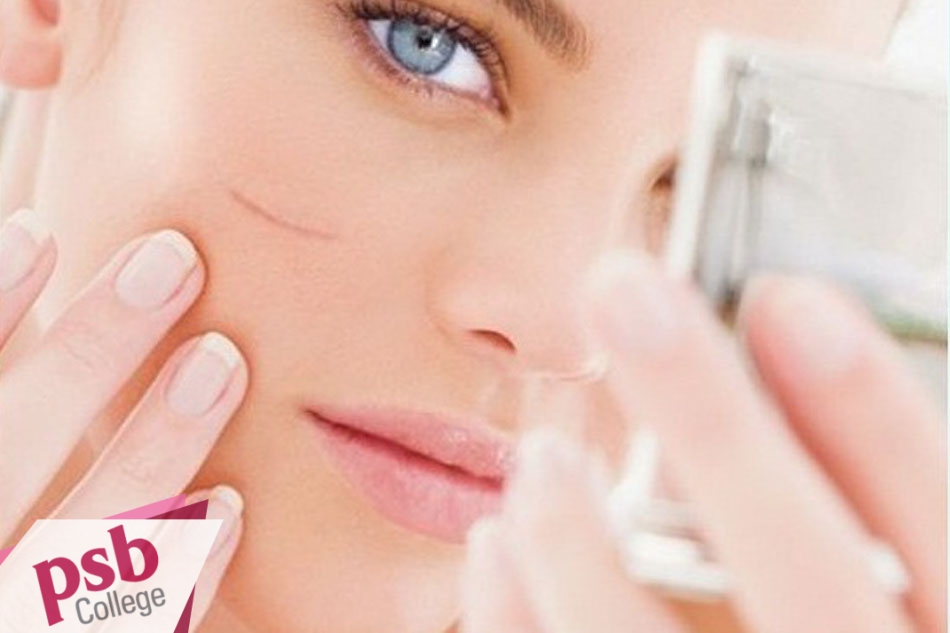 Sẹo lồi ở khuôn mặt ảnh hưởng rất lớn đến giao tiếp hằng ngày