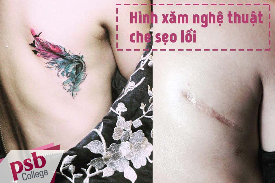 Xăm hình nghệ thuật để che đi sẹo lồi