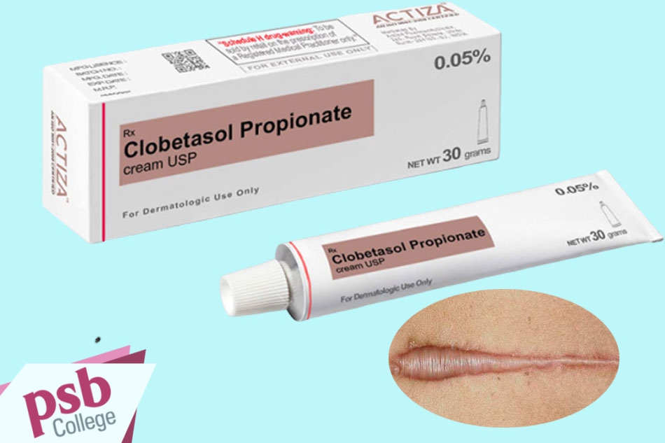 Gel clobetasol  trị sẹo lồi