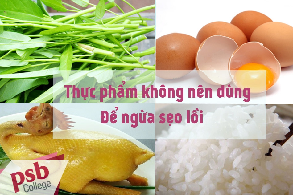 Thực phẩm nên tránh sử dụng để tránh bị sẹo lồi