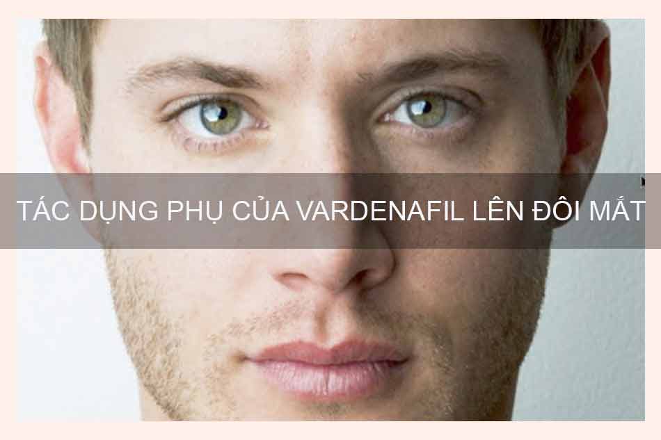 Levina( Vardenafil) có thể gây rối loạn thị giác