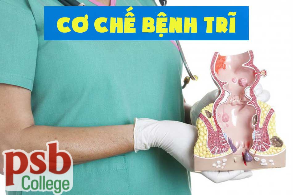 Cơ chế bệnh trĩ