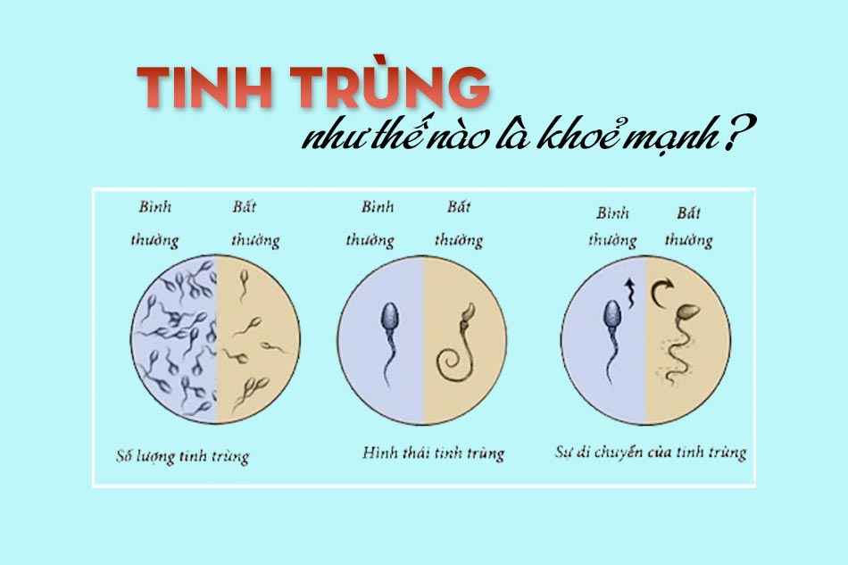 Tinh trùng như thế nào là khoẻ mạnh?