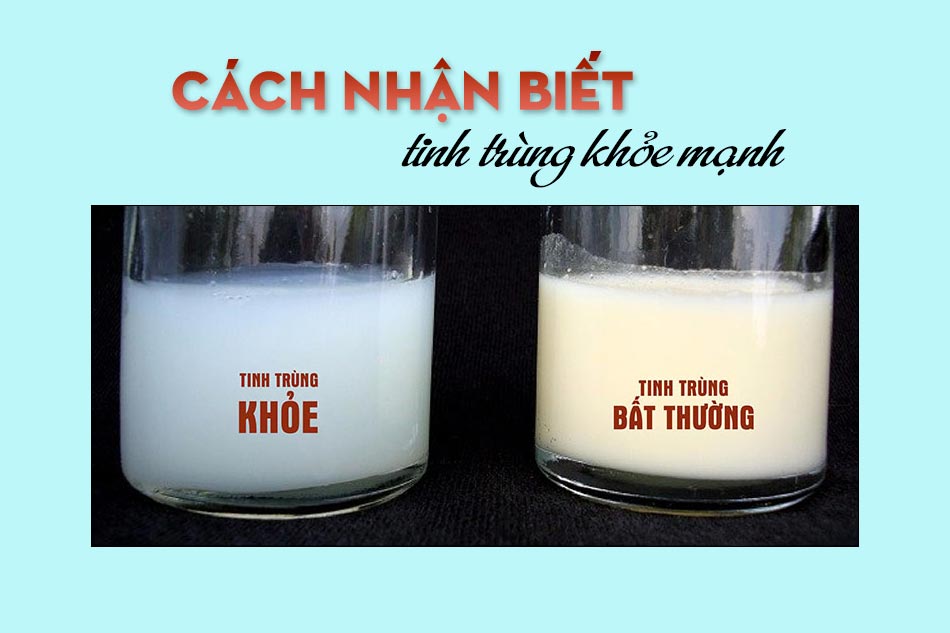 Nhận biết tinh trùng không khỏe mạnh