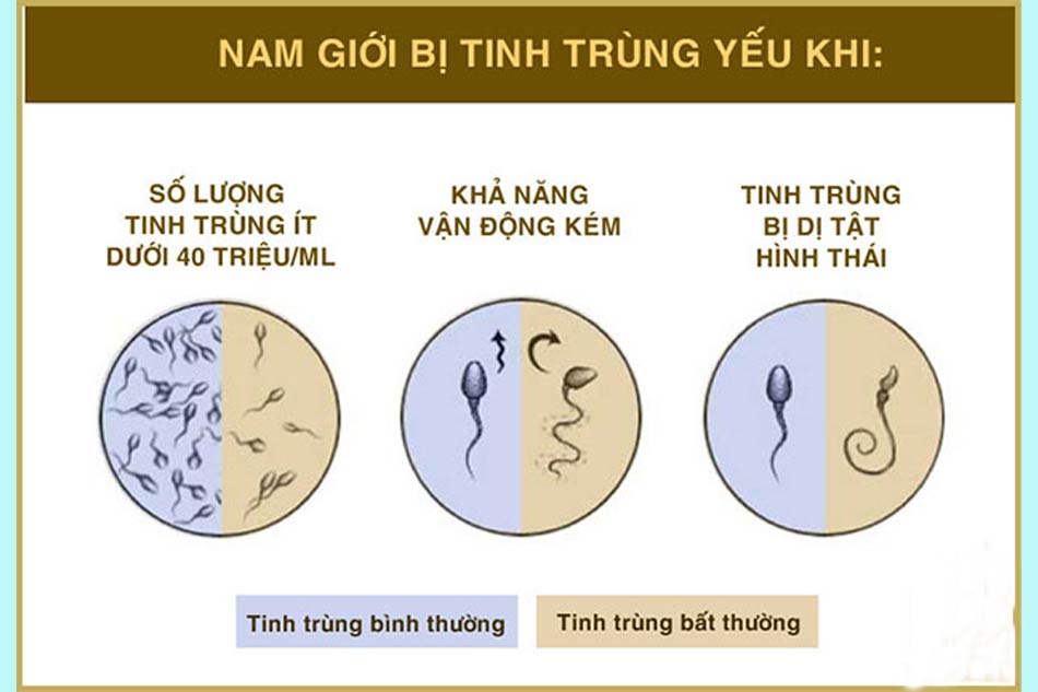 Tinh trùng yếu là như thế nào?