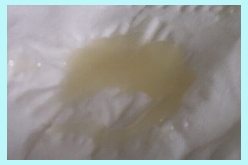 Tinh trùng yếu sống được bao lâu sau khi xuất tinh?