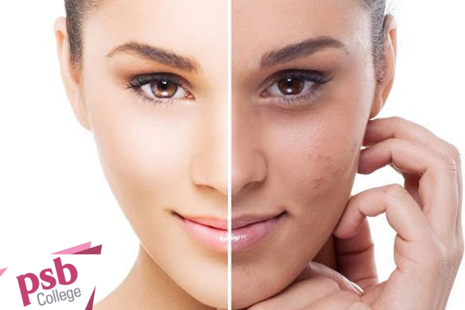 Loại bỏ các tế bào chết trên da